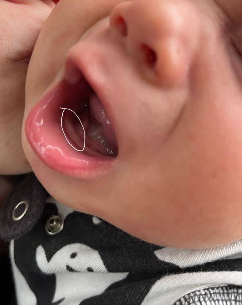 Dr_sani Rx 💉💊🔬 tweet media