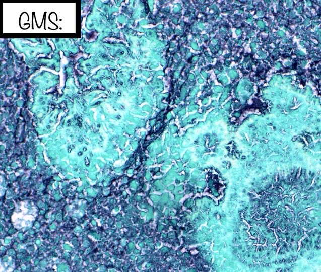 Brown Pathology and Laboratory Medicine tweet media