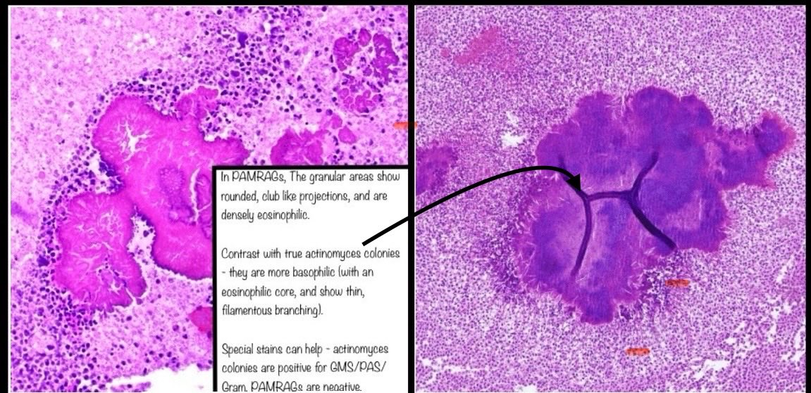 Brown Pathology and Laboratory Medicine tweet media