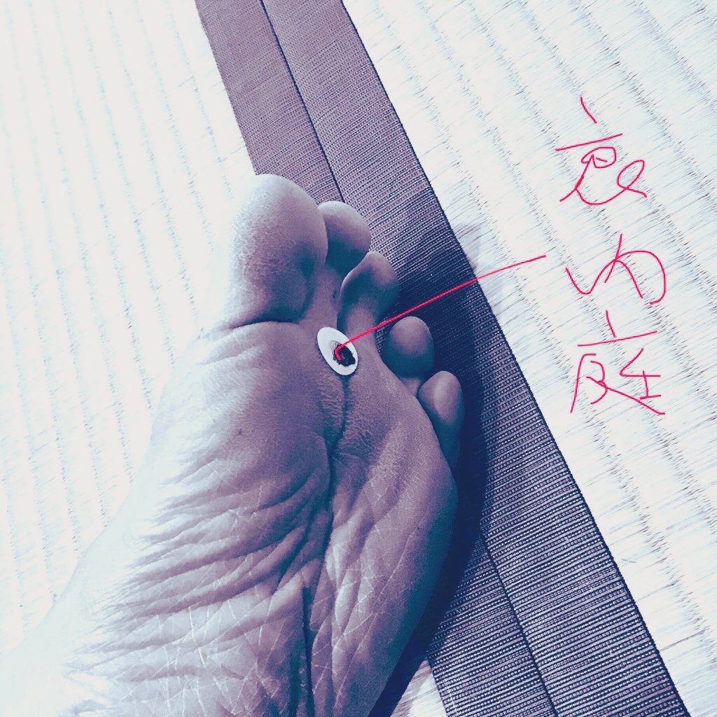 dCNZ85zXLoaQNkR's tweet photo. 家族全員の花粉症（鼻水）がとまった←‼️

これは神←✨

神はツボに宿る https://t.co/JiyIE6TgF2