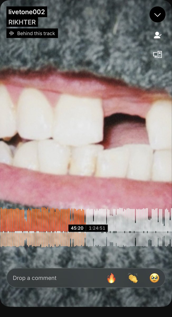 Idk I just feel like we don’t appreciate this set enough