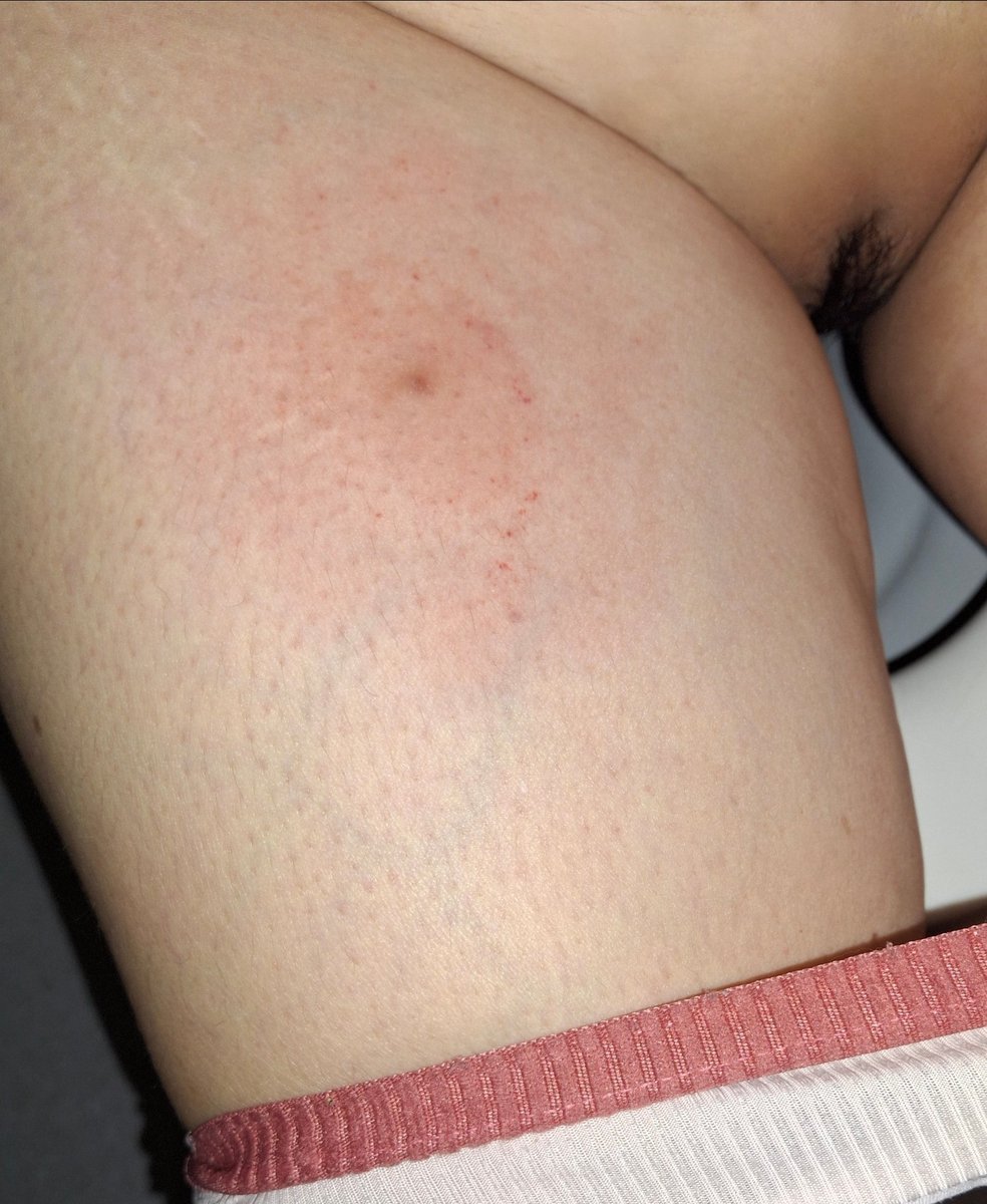 🇲🇽☆ MEXA ☆🇲🇽 tweet media