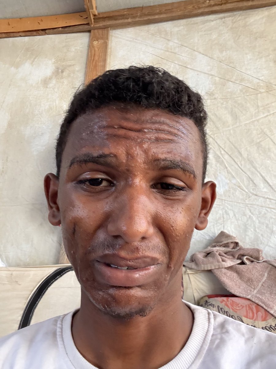 I will not forgive anyone who sees this post and does not support me with a single word and ignores me.

If you see this, leave even a dot.

chuffed.org/project/168480…