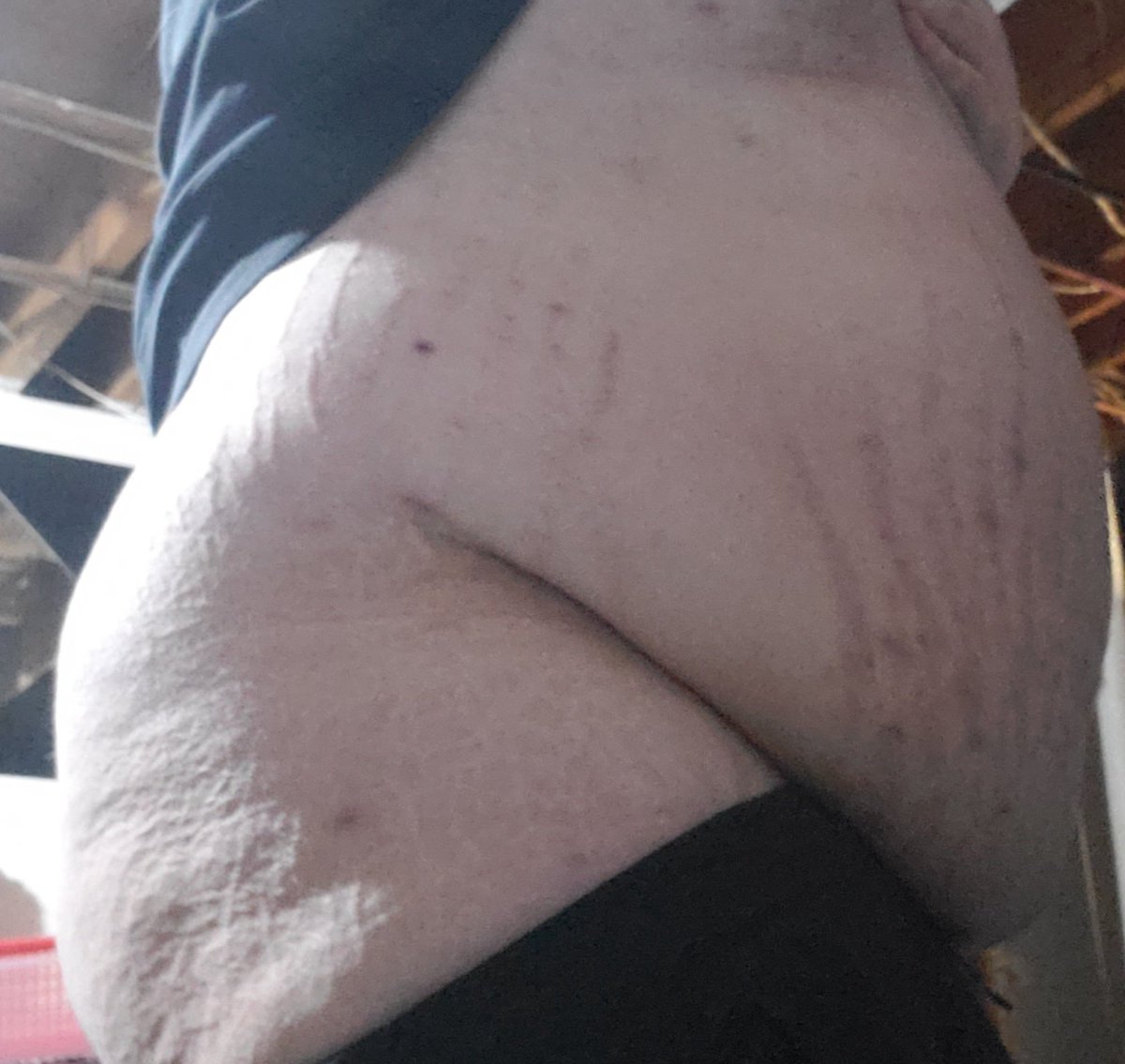 LoafNasty's tweet photo. 300lbs of fox fat heh https://t.co/KoMtNtP6Cm