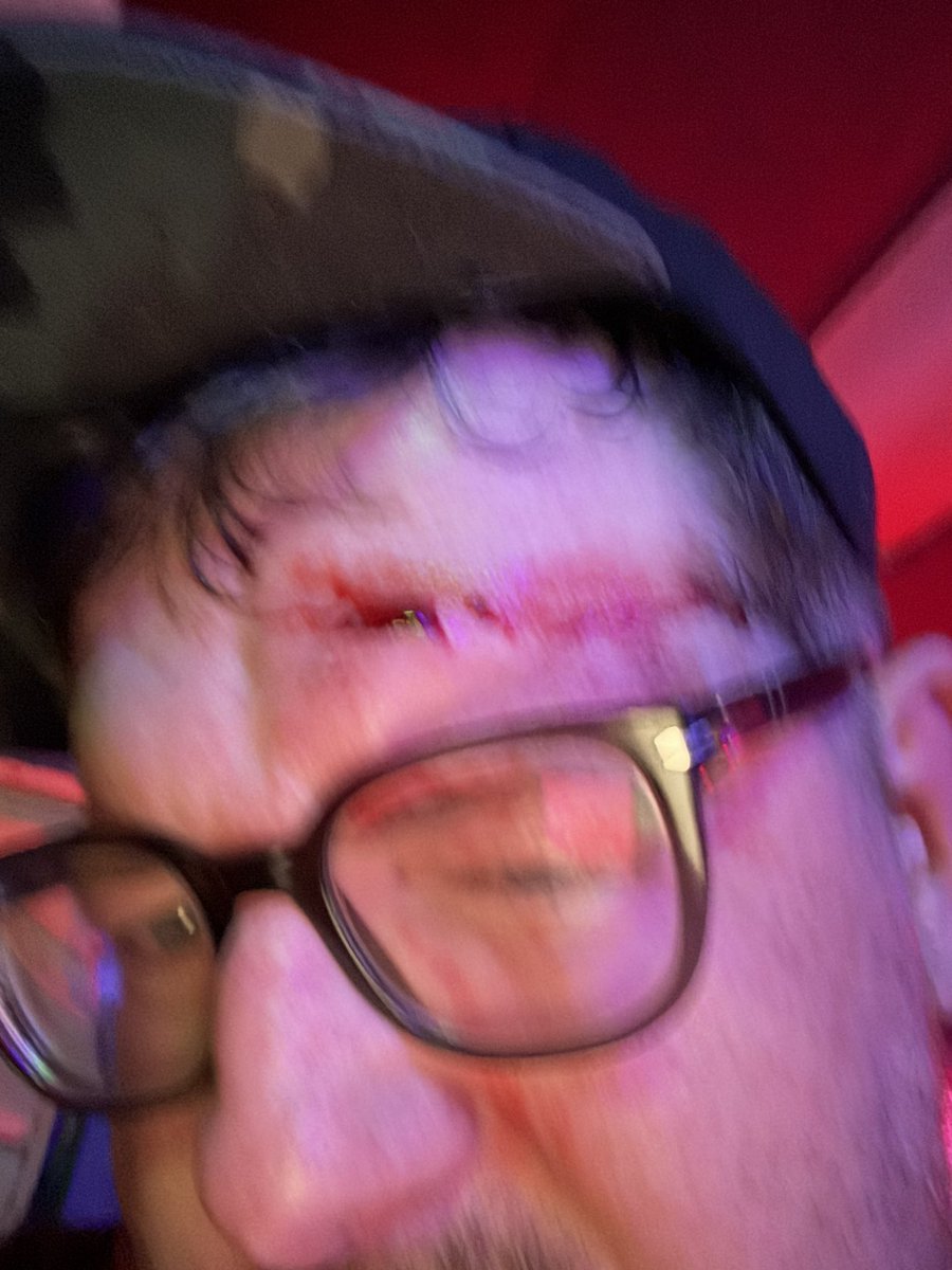 Question for the <a href="/hardlorepod/">HARDLORE</a> …. How old is too old to get your forehead cut open (maybe a stage diver or an elbow I’m not quite sure when it happened) at a TERROR show? I’m 37 with two kids, a wife, and a mortgage…. 10/10 show #OrlandoHxC