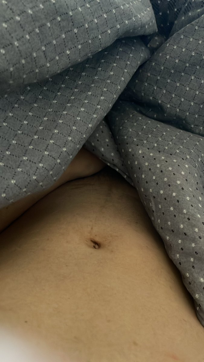 井底之呱呱 tweet media