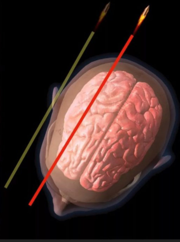 Poods.TROLL | troll.TROLL ⛏️ tweet media