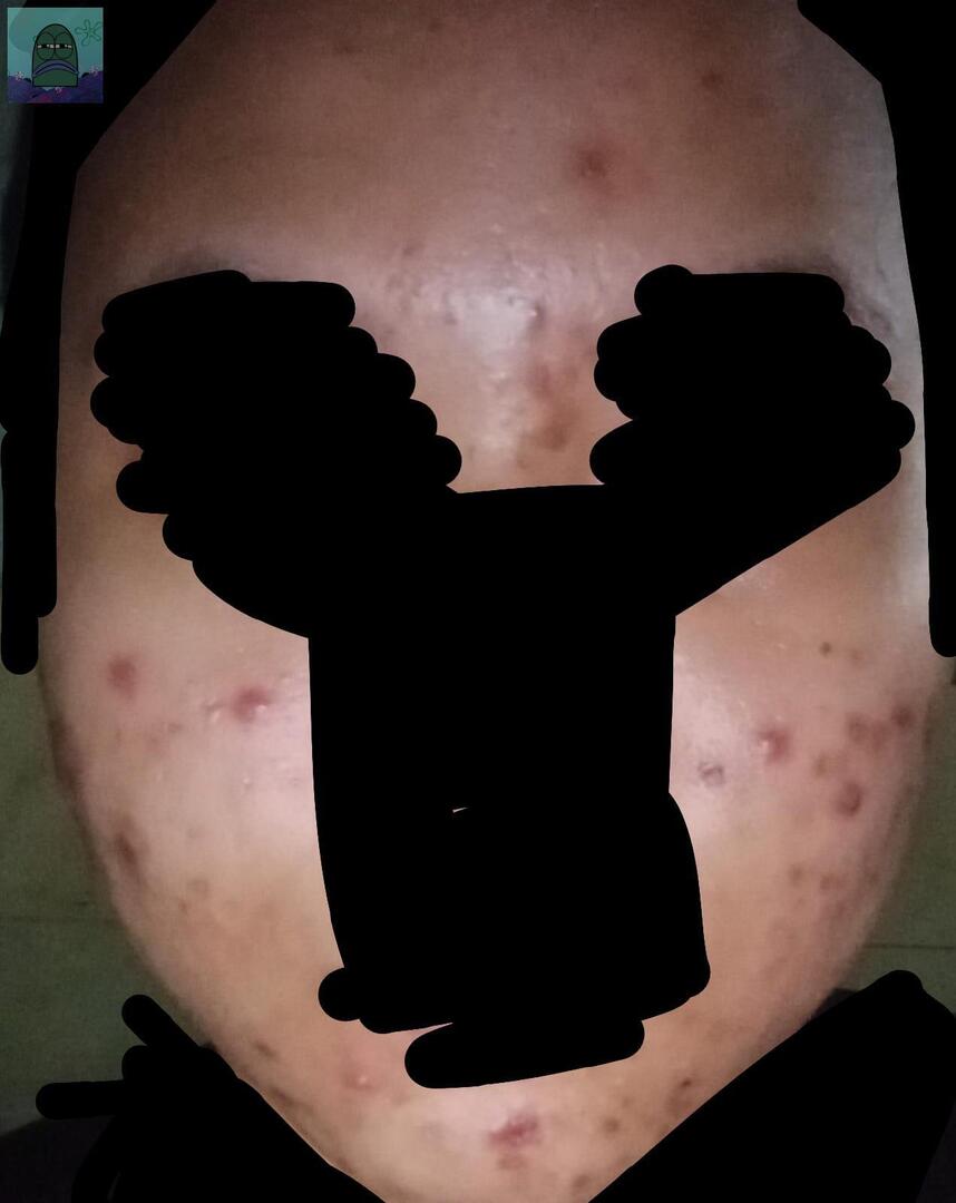 Tanyarl 💚 tweet media