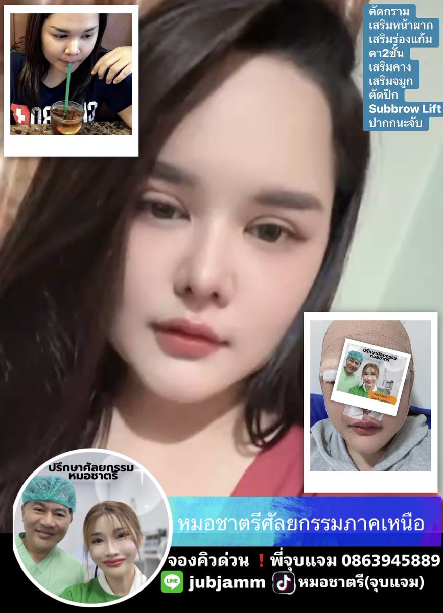 O2MUgkaZ1sfpmWa's tweet photo. #ปรับโครงหน้าหมอชาตรี https://t.co/2nKhClMFZT