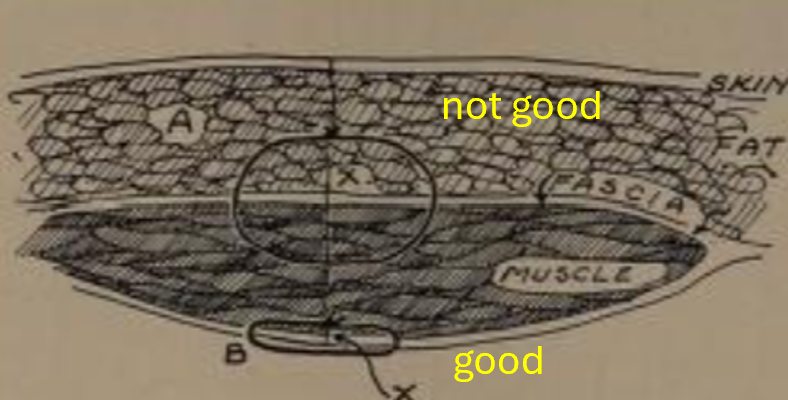 Ron Barbosa MD FACS tweet media