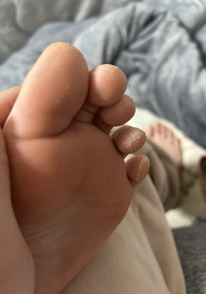 後、3日間は靴下を履かないと…
汚しマシーンになってしまう

#BabyFoot