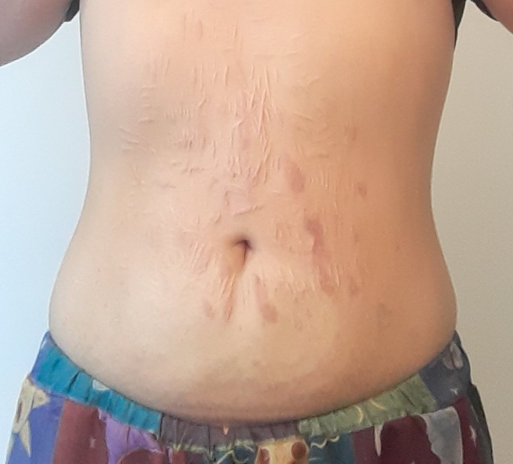 bmi 33 vs bmi 24. i'm so fucking locked in