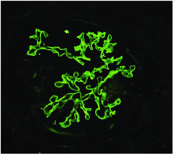 Medzonetv tweet media