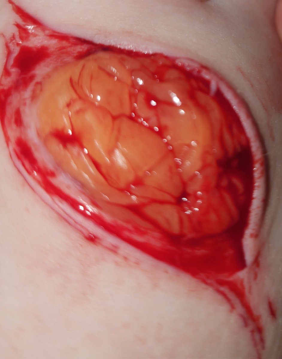 mikey ♰ tweet media