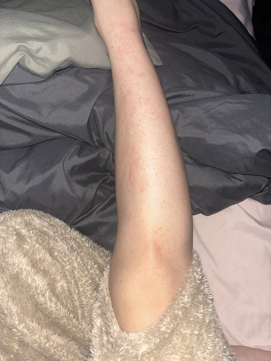 卖萌被肘击 tweet media