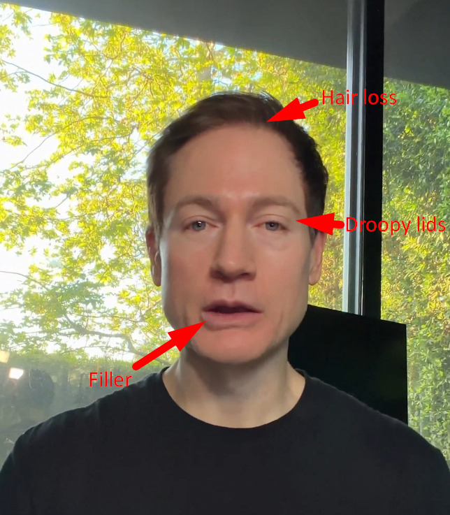 ImNotTheWolf tweet media