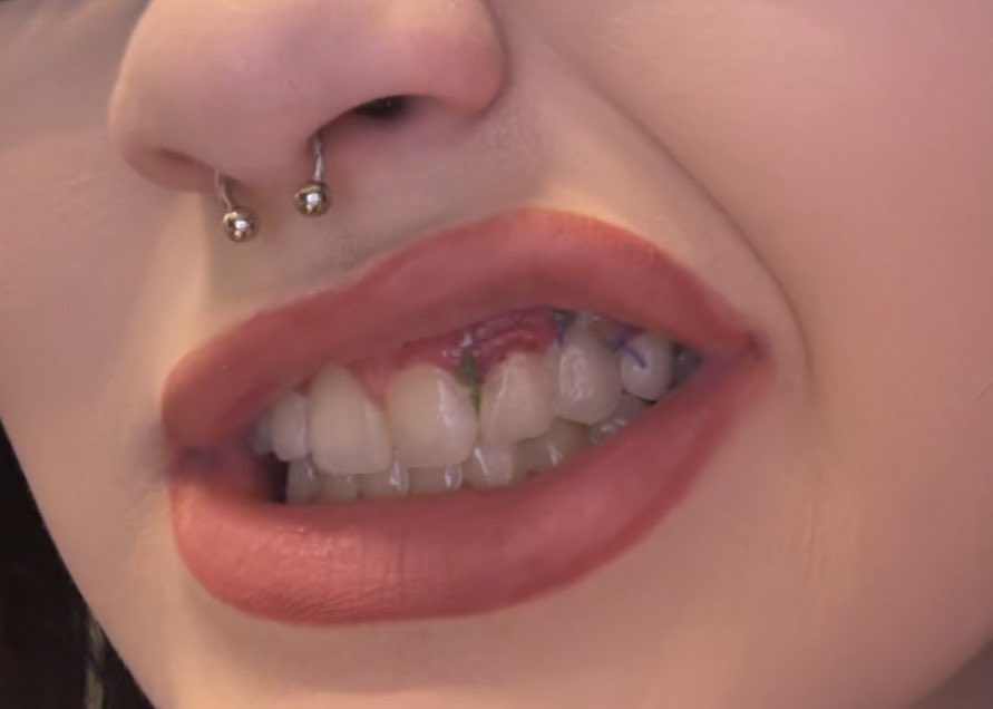 monkey spit tweet media