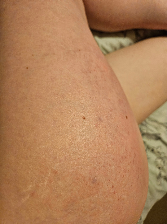 🔞 Mara Vespidae 🎀🐝 tweet media