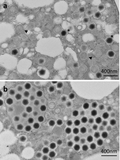 CitemChile's tweet photo. Así se ve ushikuvirus dentro de la célula infectada.
La microscopía electrónica revela partículas con genoma, partículas vacías y una gran acumulación de viriones en el citoplasma a solo 5 h postinfección. Una imagen clave para entender la biología de este nuevo virus gigante. 🔬 https://t.co/J4Ecdl0yez