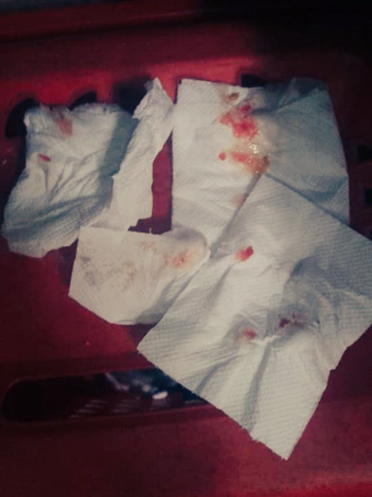 Pingonact1 tweet media