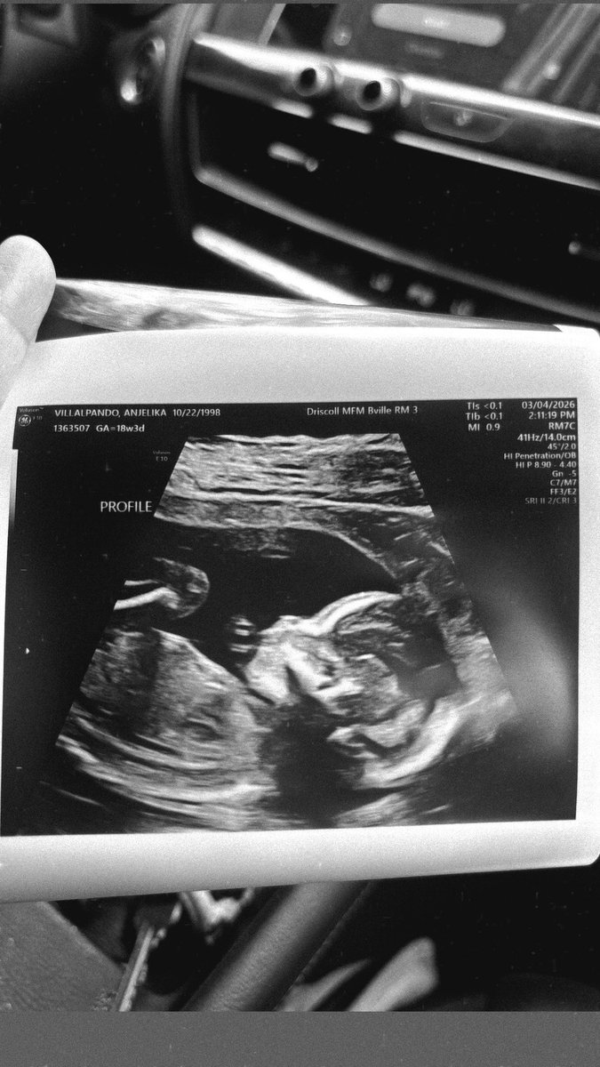 anjelikarv's tweet photo. life update: we’re having a baby boy and we bought a house 🏠 👣🩵
2026 has been so good to us, August can’t come soon enough 🥹 @rarreola7890 https://t.co/iJrvzSPZNw