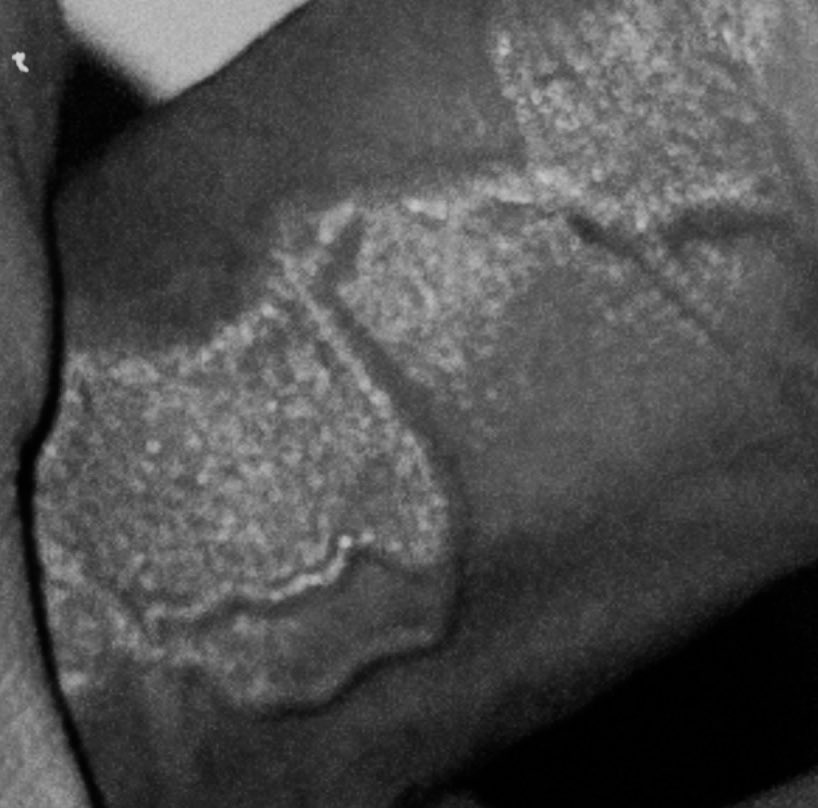 สกรูนอตท์ tweet media