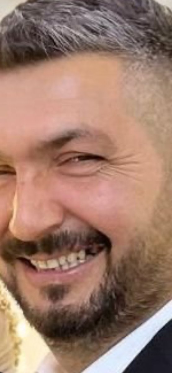 _Ezmelek's tweet photo. @GToprak3258 Sen git o olmayan çürük dişini yaptır aç köpek🤮 https://t.co/Yz7XQddV2E