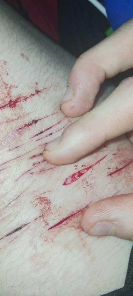 Kimi Of Shedtwt tweet media