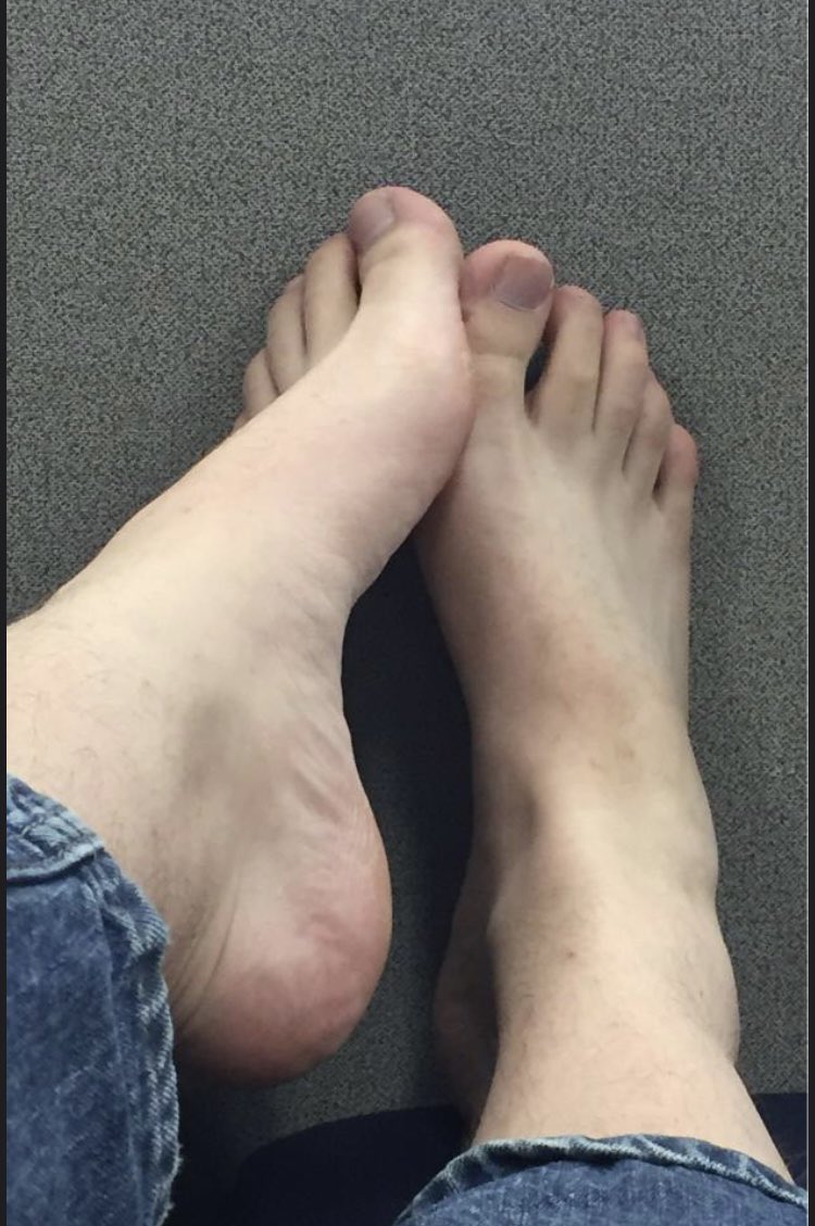 SimplySage247's tweet photo. Something naughty for you that are into feet, my size 13s. Want more? Message for personal and exclusive content 💵🤑 #footfetısh #gaystuff #feet https://t.co/of97yMsXH8