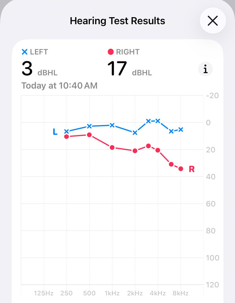 Was super sick this week and it left me with, among other things, inflammation in my right ear and w