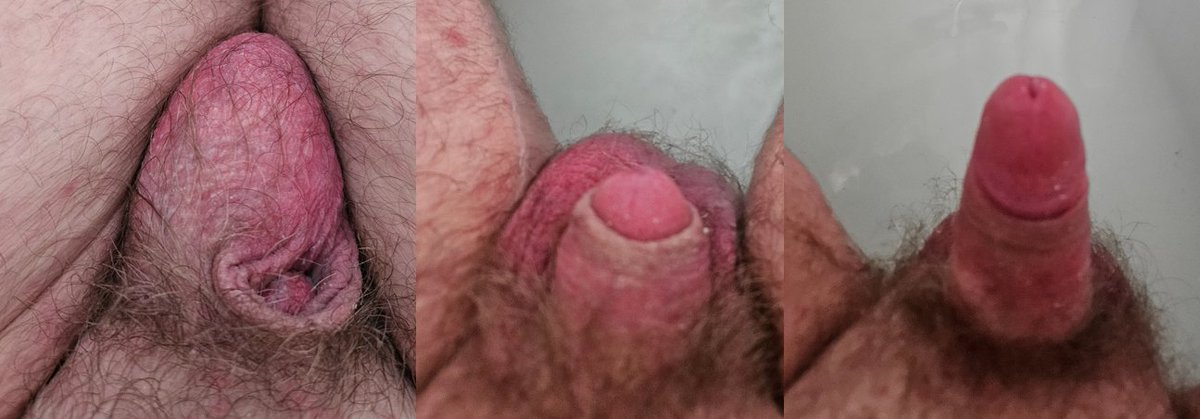 Small Dick World tweet media