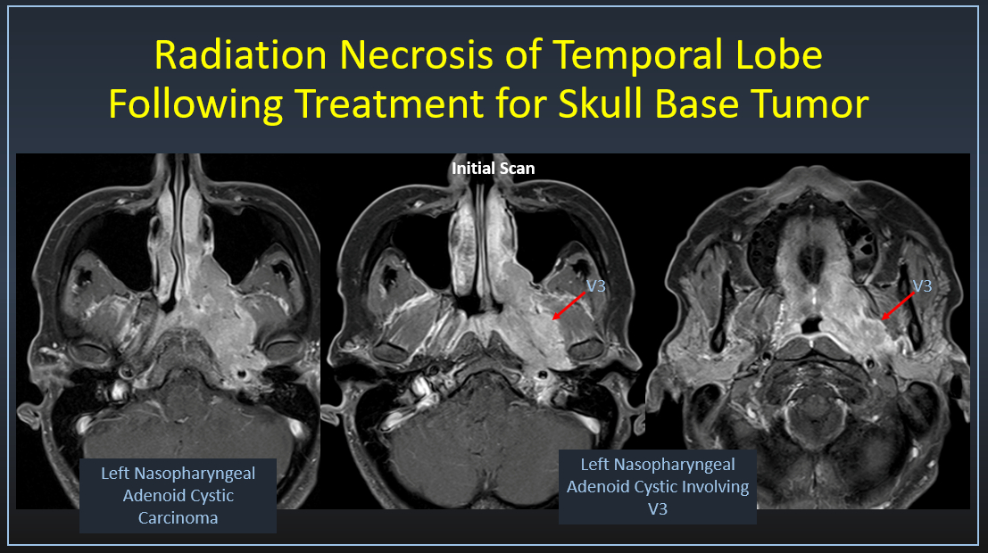Philip R. Chapman, MD tweet media