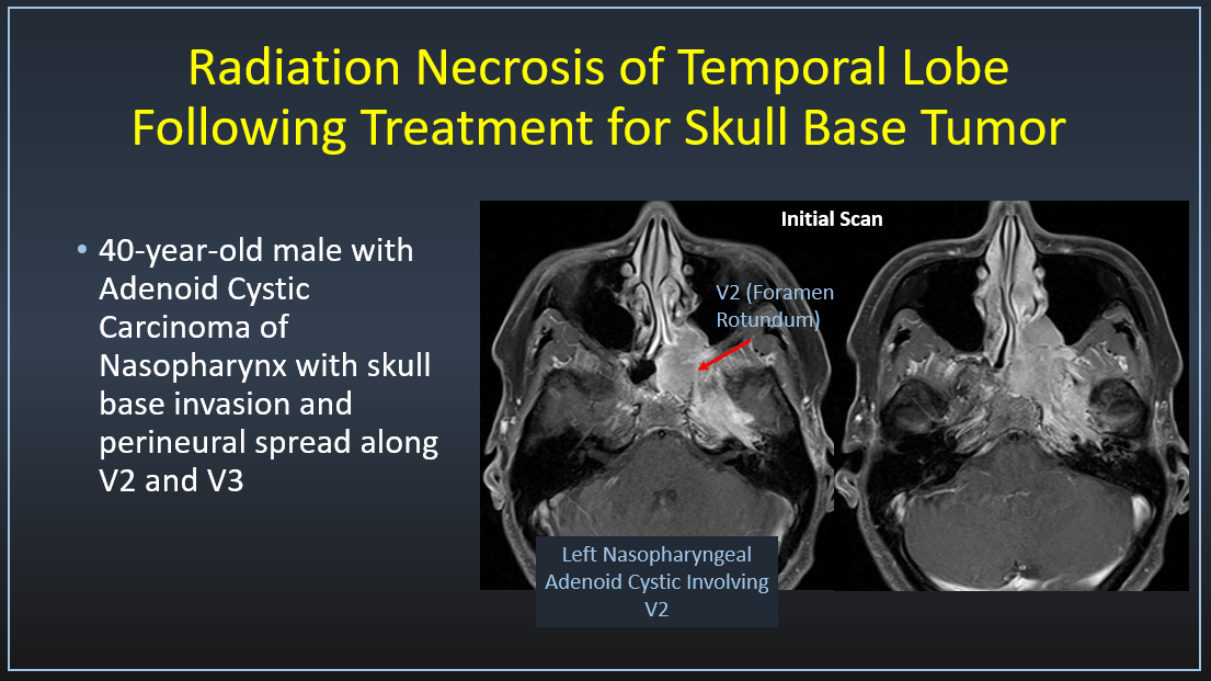 Philip R. Chapman, MD tweet media