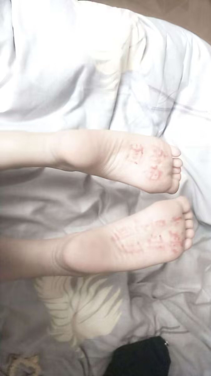 淚水是我的刺青 tweet media