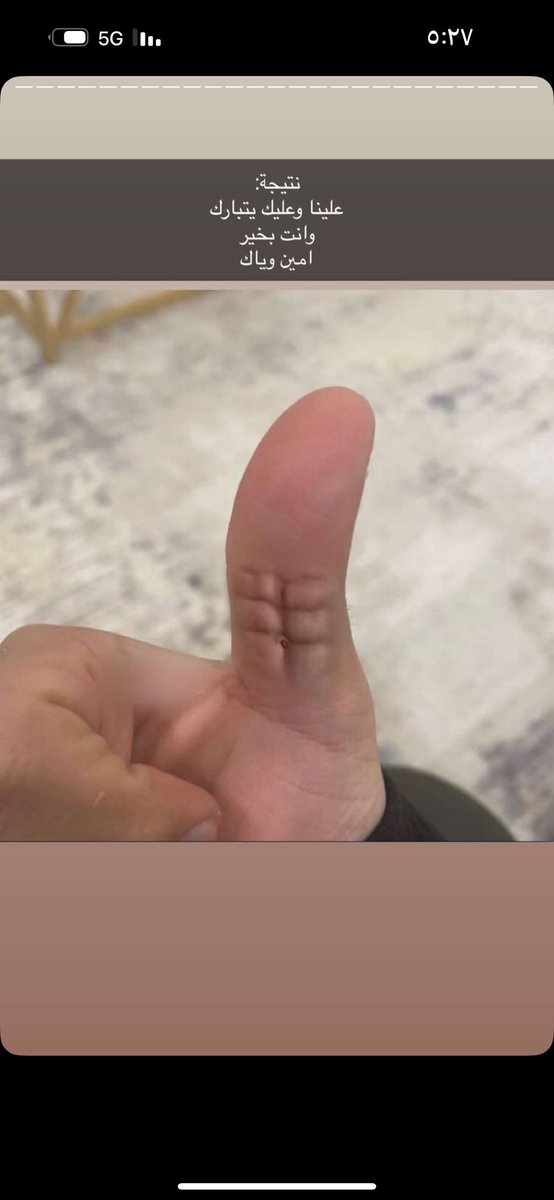 يحصل الانن