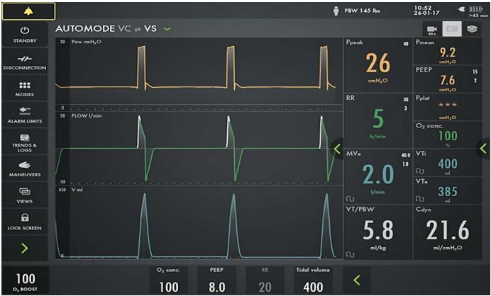 Society of Mechanical Ventilation tweet media