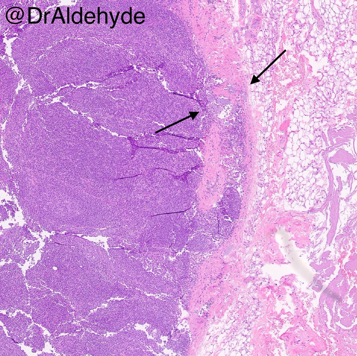 Woo Cheal Cho, MD tweet media