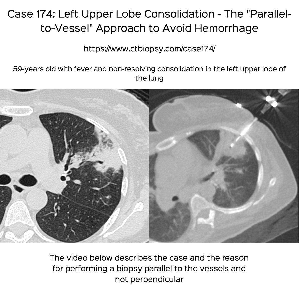 Bhavin Jankharia tweet media