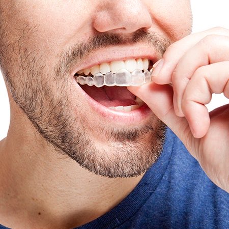 SwinneyDental's tweet image. Your smile, upgraded.

Invisalign® offers a discreet, comfortable way to straighten your teeth—no brackets, no wires, no hassle.

Schedule your consultation today and see what’s possible.

#SmileUpgrade #InvisalignLife #DentalCare #SwinneyDental