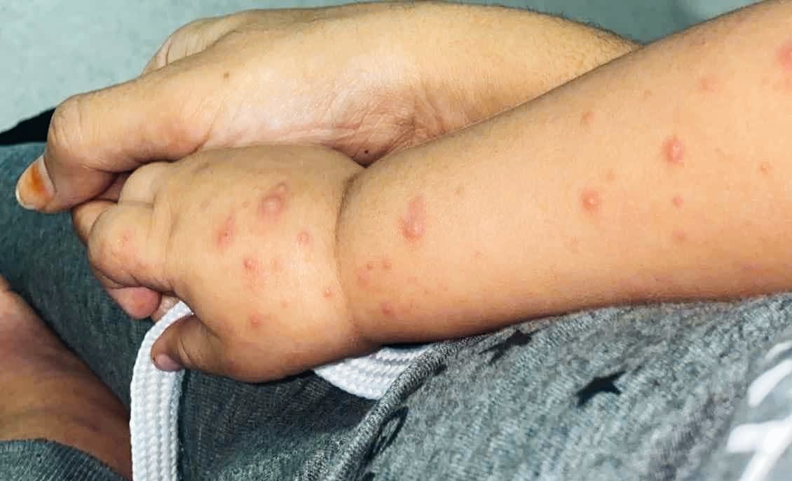 Mohannad tweet media