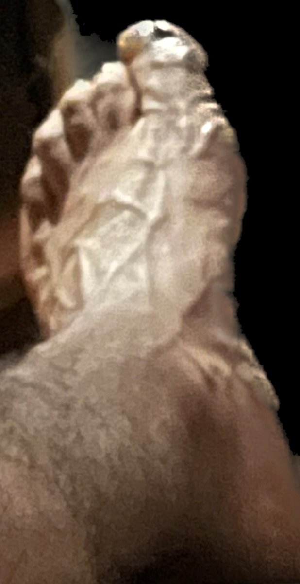 Outlier: Type 2 Civilization Supervisor®️ tweet media