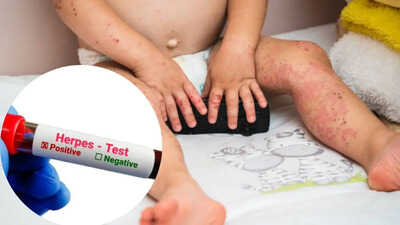 The General tweet media