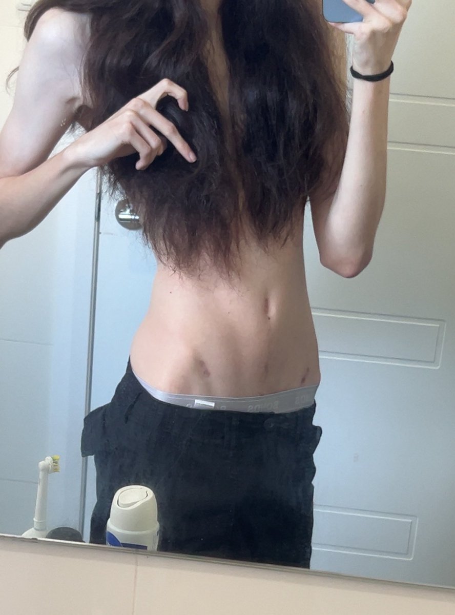 twigsly 🦴 tweet media