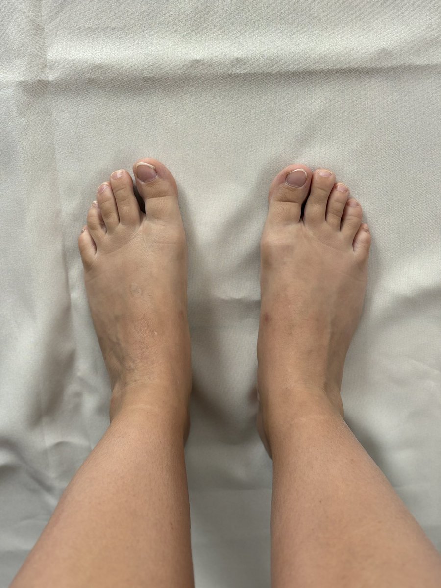 ArteMagicaOF's tweet photo. Some pics just for you 😘
Visit my page for more
https://t.co/9mCaoFsxtz
#feet #feetfetısh #foot #footfetısh #onlyfanspost https://t.co/vD9s8f46ft