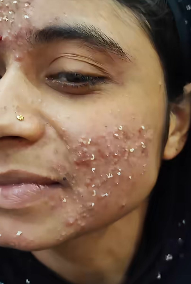 Rahul Sikarwar tweet media