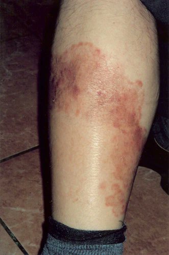 Dr. Akhil 🇮🇳 tweet media