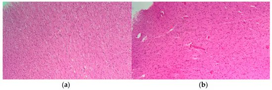 Biomed_MDPI's tweet image. 🎯 EDITOR’S PICK | A standout article selected by our editors 
📌 Title: SARS-CoV-2-Related Olfactory Dysfunction: Autopsy Findings, Histopathology, and Evaluation of Viral RNA and ACE2 Expression in Olfactory Bulbs
🔗 Link: mdpi.com/2227-9059/12/4…
#EditorsChoice #RecommendedRead