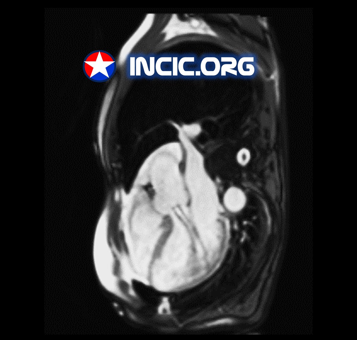 Julián Vega Adauy tweet media