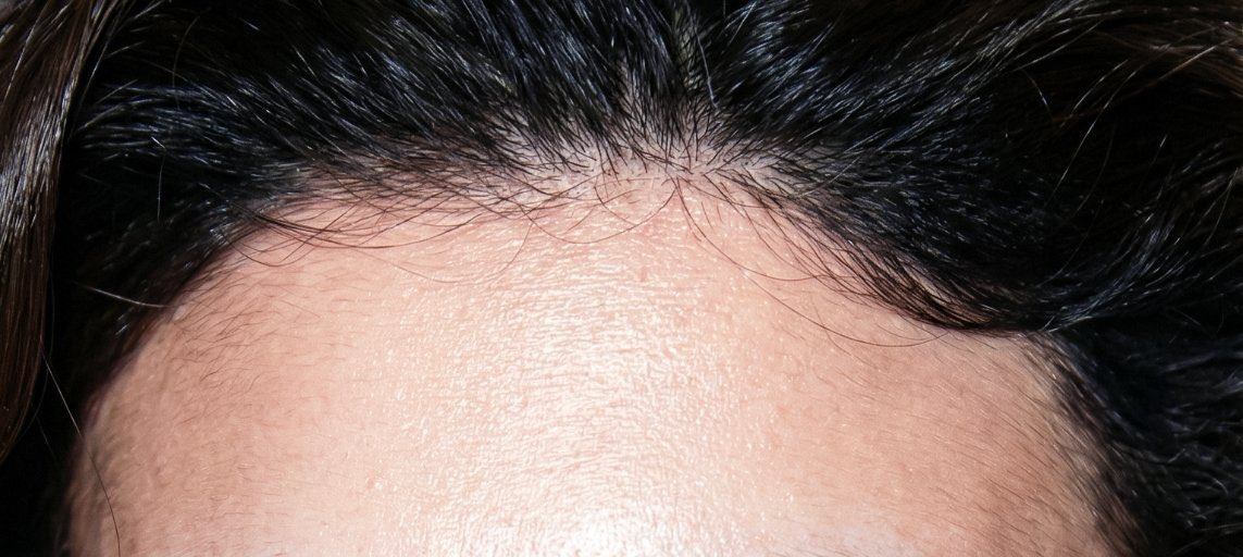 Siddarth Awax tweet media