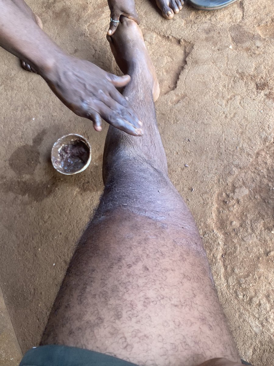 mekus 🦍 tweet media